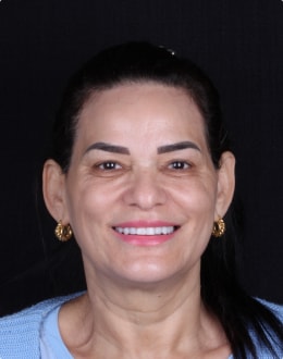 Resultado Lente Dental