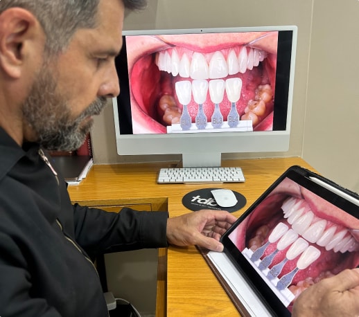 Dr. Miguel Sattler - Estudo de Lente