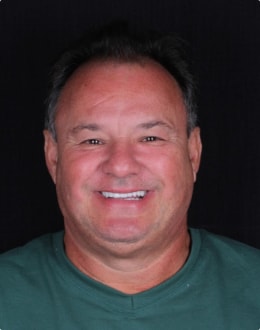 Resultado Lente Dental